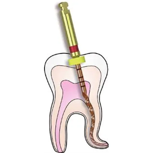 DIADENT DIA-X FILE D4 FINISHING FILE 25mm ROOD F2 (4st) 571-204