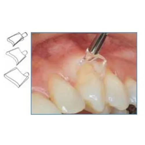 LM GINGIVAL RETRACTOR SCHILDJES MEDIUM NR.7504