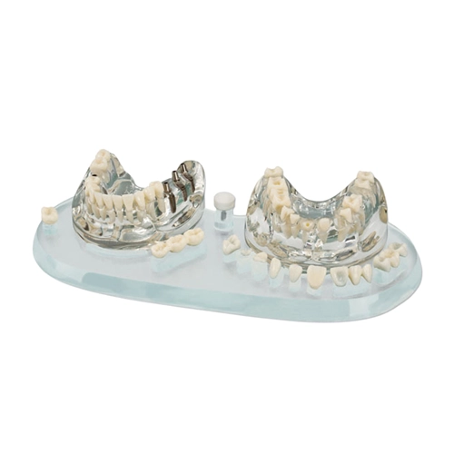 HAGER&WERKEN STUDIEMODEL IMPLANT C+B KOMPLEET