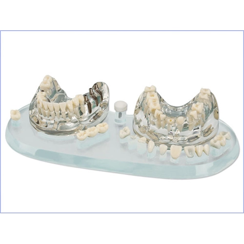 HAGER&WERKEN STUDIEMODEL IMPLANT C+B KOMPLEET