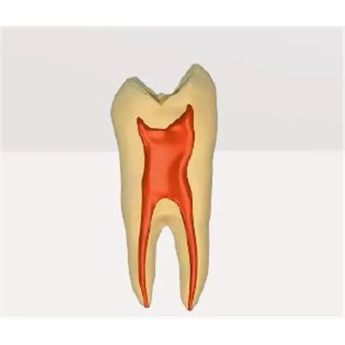 DRSK ENDO-TRAINING-BLOC MAXILLARY FIRST MOLAR TYPE II NR. 2634-201-PCL2 (Pre-accessed, Transparent)